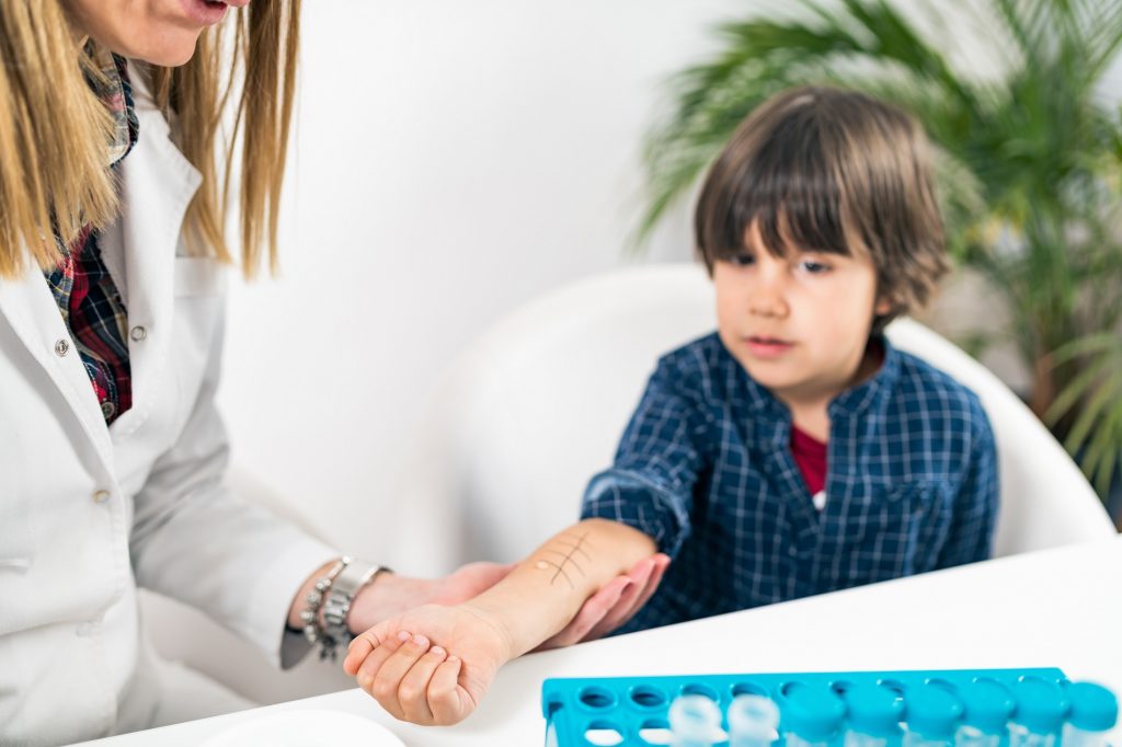 Allergy - Skin Prick Testing