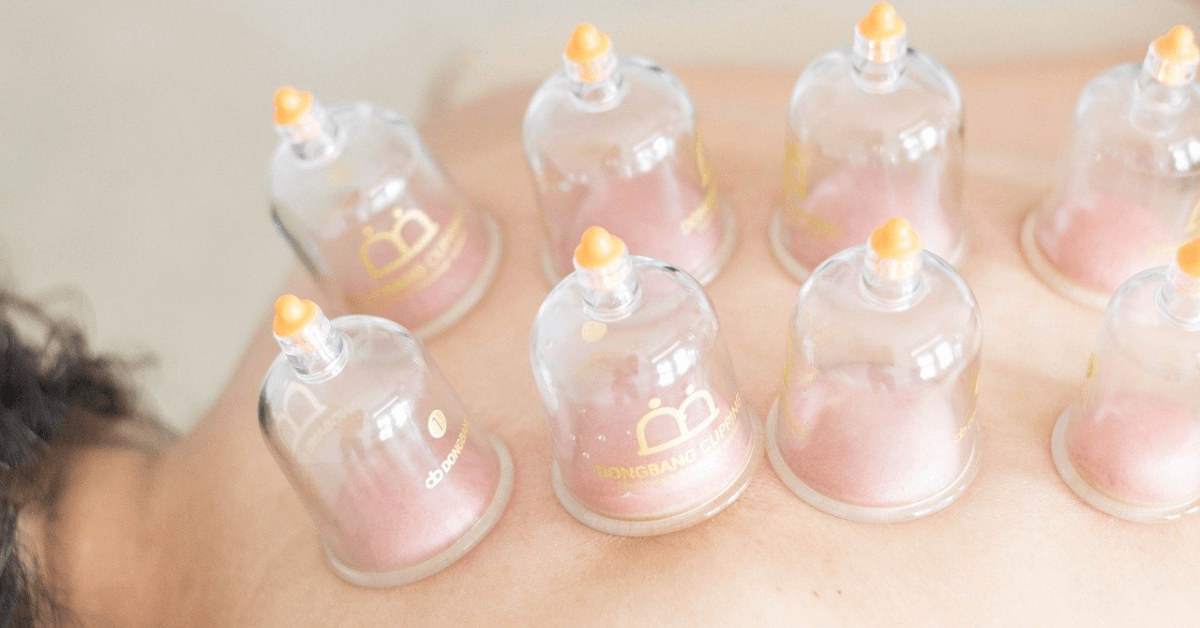 cupping therapy in Orlando