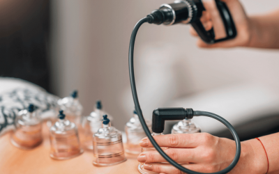 Everything You Need To Know About Cupping Therapy And Its Benefits