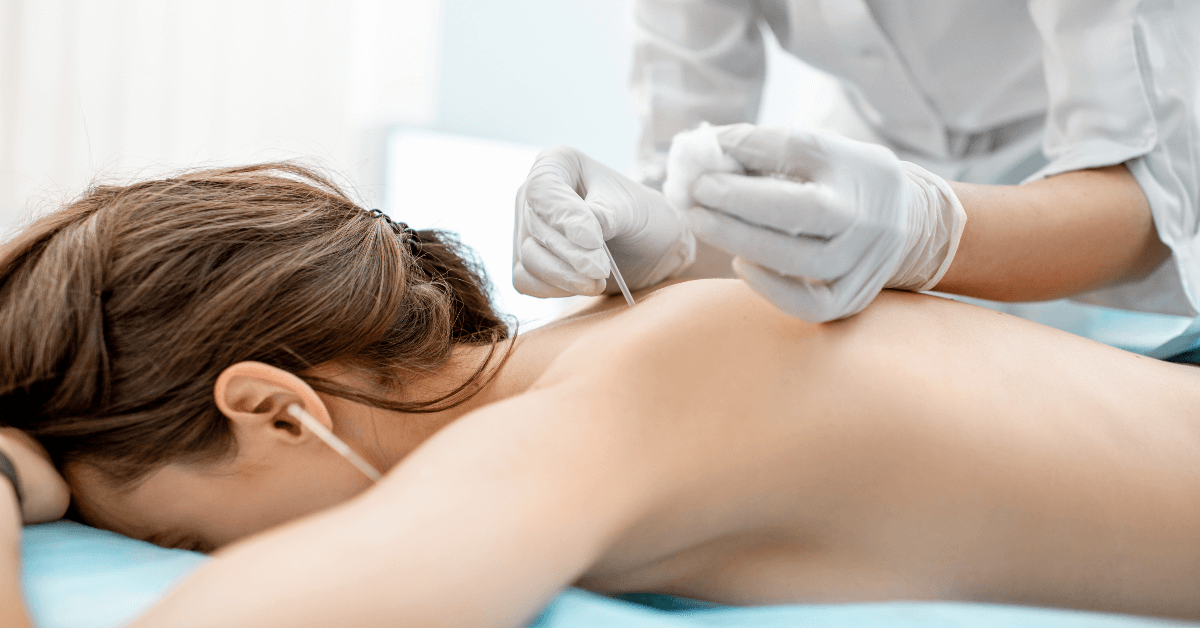 Medical Acupuncture Near Me