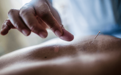 Enhance Your Well-being with Acupuncture at Winter Park Chiropractic
