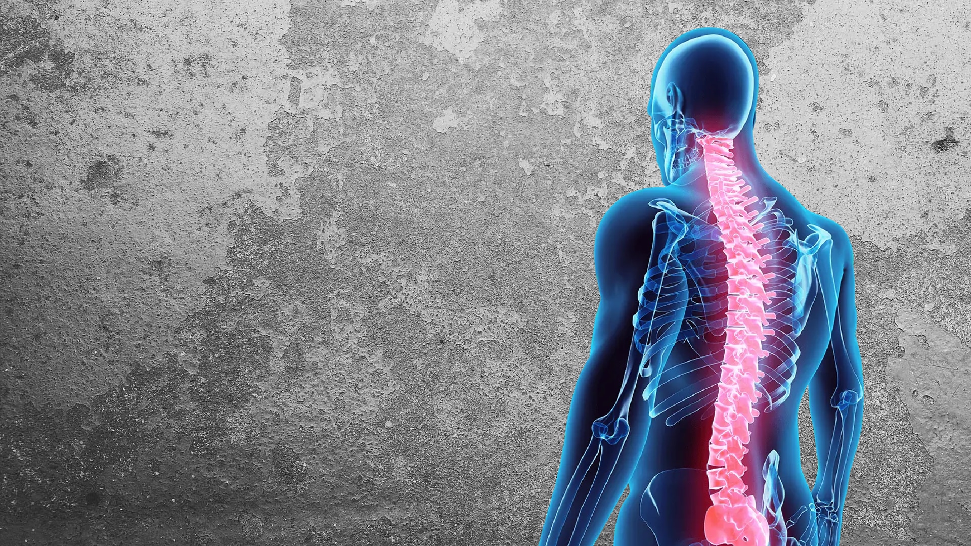 Backbone Pain Relief winter park chiropractic