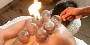 A Holistic Approach to Health and Wellness with Cupping Therapy