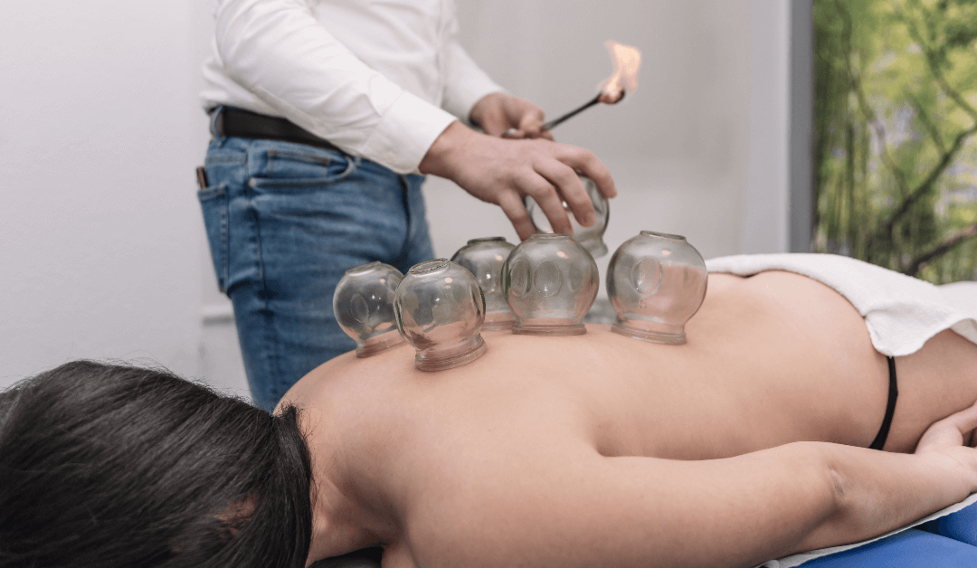 Winter park Chiropractic | Chinese Cupping Therapy