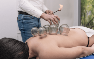 Exploring the Art and Benefits of Chinese Cupping Therapy