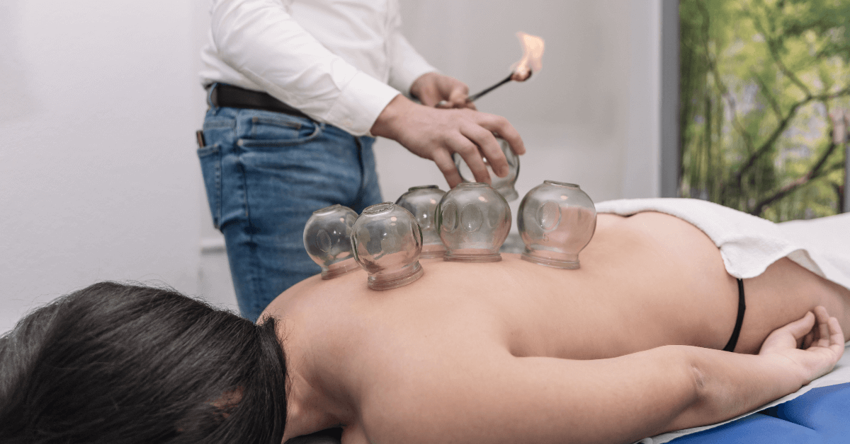 Winter park Chiropractic | Chinese Cupping Therapy
