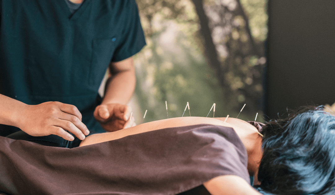 Balancing Wellness: Exploring the Benefits of Acupuncture