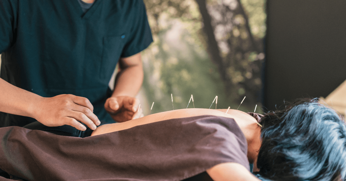 Acupuncture Near Me