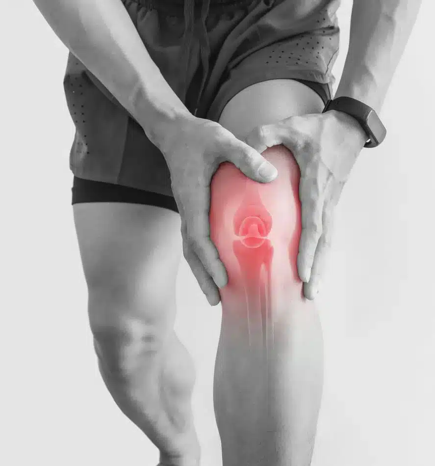 Sports Injuries: Sports Injuries: