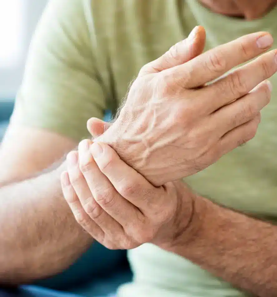 Osteoarthritis, Rheumatoid Arthritis Osteoarthritis, Rheumatoid Arthritis