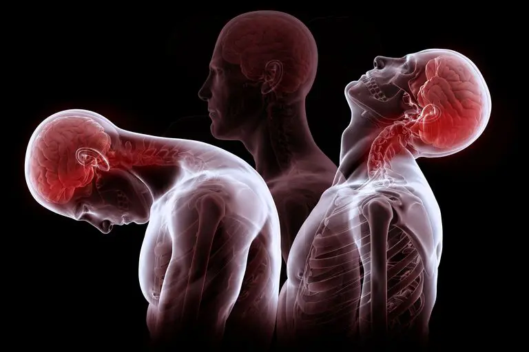 Personal Injury Chiropractic