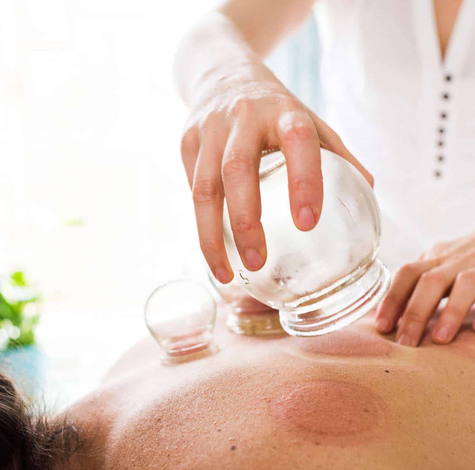 Chiropractic Care with Chinese Cups Therapy