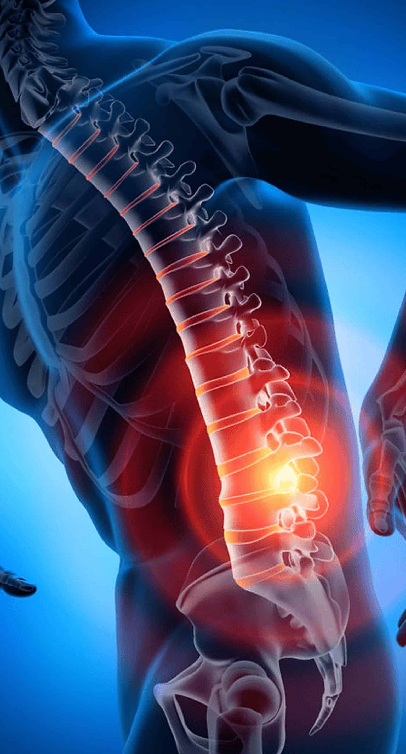 Platelet-Rich PlasmaTherapy