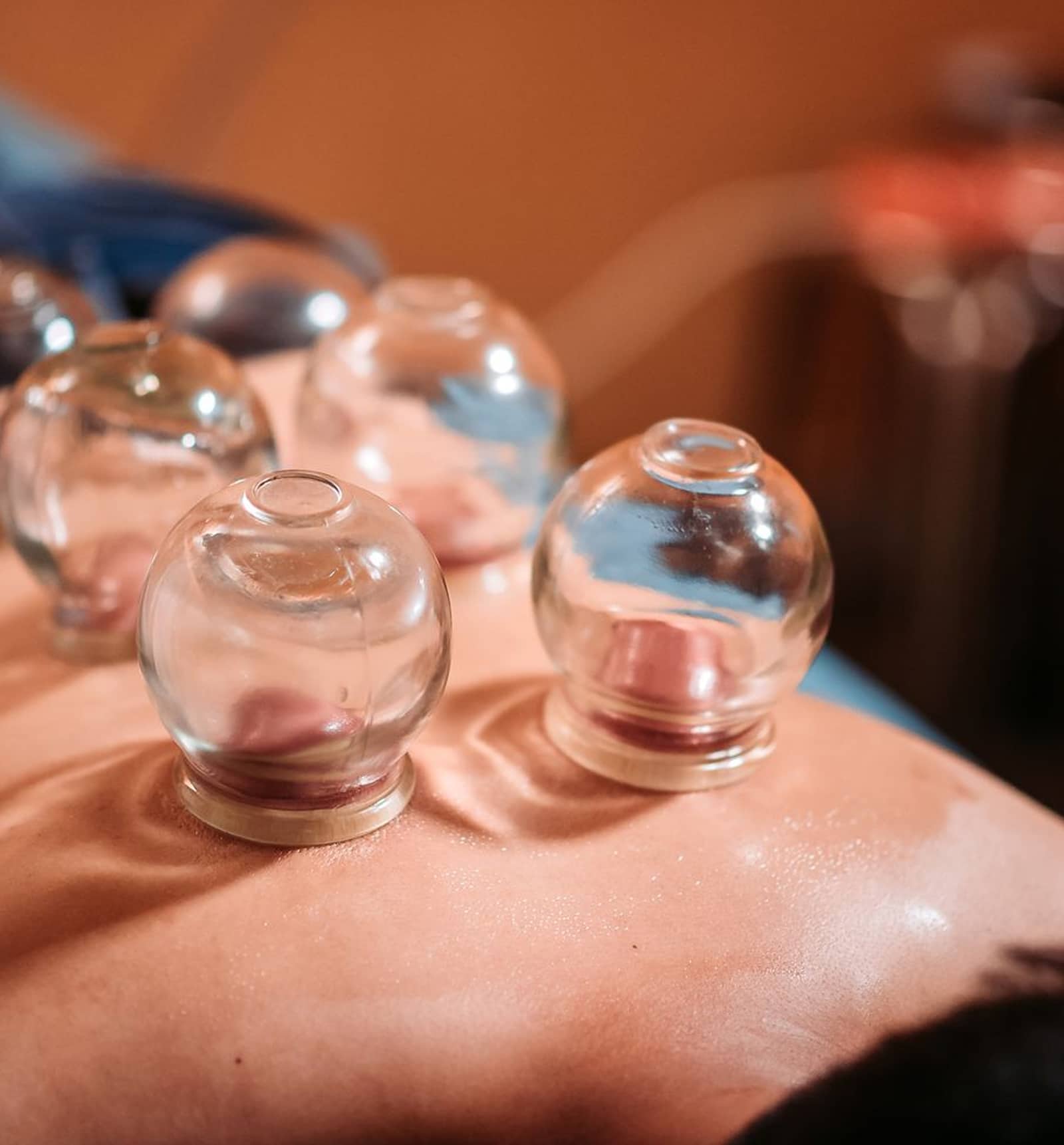 Skin During Cupping