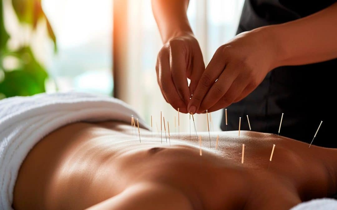 does acupuncture help with back pain