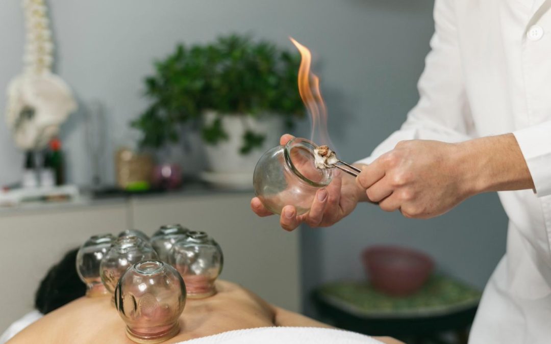 what is chinese cupping therapy and how does it work