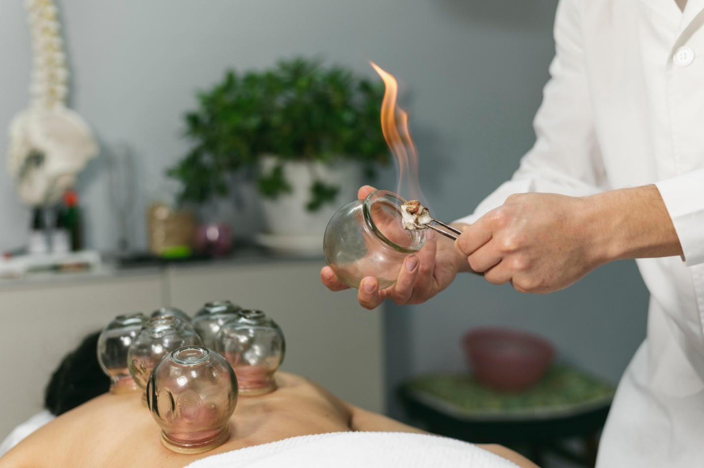 what is chinese cupping therapy and how does it work