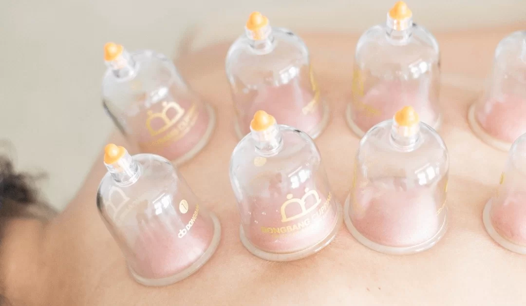 Cupping Therapy – Learn About The Major Benefits