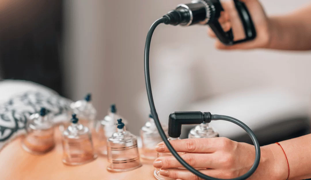 Everything You Need To Know About Cupping Therapy And Its Benefits